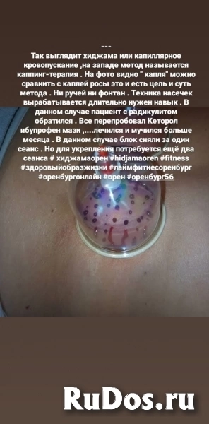 Хиджама здоровье без лекарств изображение 3