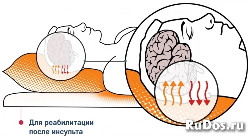 Мягкие модули с наполнителем из микросфер для лечебной физкультур изображение 5