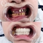 Протезирование зубов в Китае картинка из объявления